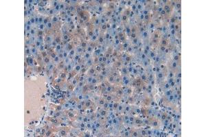 Used in DAB staining on fromalin fixed paraffin- embedded liver tissue (RANKL anticorps  (AA 106-240))