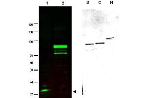 Image no. 1 for anti-SPANX Family, Member C (SPANXC) antibody (ABIN401033) (SPANXC anticorps)