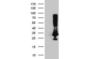 Image no. 2 for anti-Phenylethanolamine N-Methyltransferase (PNMT) antibody (ABIN1500313) (PNMT anticorps)