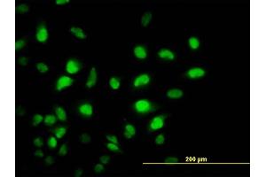 Immunofluorescence of monoclonal antibody to PCAF on HeLa cell. (KAT2B anticorps  (AA 353-452))