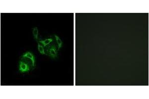 Immunofluorescence analysis of A549 cells, using SLC27A4 Antibody. (SLC27A4 anticorps  (AA 61-110))