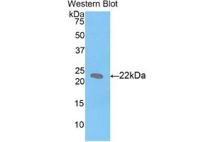 Detection of Recombinant LIF, Mouse using Polyclonal Antibody to Leukemia Inhibitory Factor (LIF) (LIF anticorps  (AA 25-203))