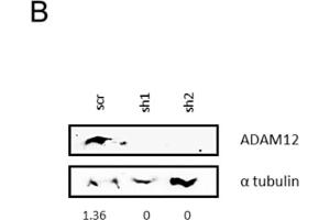 Effects of ADAM12 silencing on TNBC cell lines.
