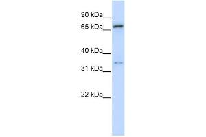 WB Suggested Anti-TRIM23 Antibody Titration:  0. (TRIM23 anticorps  (N-Term))
