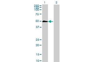 Lane 1: CALU transfected lysate ( 37. (CALU 293T Cell Transient Overexpression Lysate(Denatured))