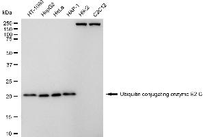 Western blotting analysis using ubiquitin conjugating enzyme E2 C antibody (ABIN7800741).
