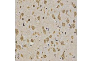 Immunohistochemistry of paraffin-embedded rat brain tissue using H3K4me3 antibody at dilution of 1:200 (x400 lens).