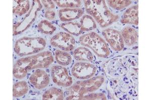 Immunohistochemical analysis of paraffin-embedded human kidney, using Caspase-3 p12 Antibody. (Recombinant Caspase 3 p12 anticorps)