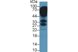 Detection of KERA in Mouse Eye lysate using Polyclonal Antibody to Keratocan (KERA)
