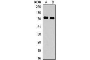 Western blot analysis of TBRG4 expression in Hela (A), HepG2 (B) whole cell lysates. (TBRG4 anticorps)