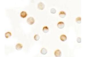 Immunocytochemistry of SLC35D3 in HeLa cells with SLC35D3at 2. (SLC35D3 anticorps  (C-Term))