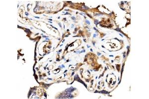 IHC analysis of Stathmin 1 using anti-Stathmin 1 antibody (ABIN3043301). (Stathmin 1 anticorps  (N-Term))