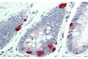 Detection of FUR in Human Colon Tissue using Polyclonal Antibody to Furin (FUR)