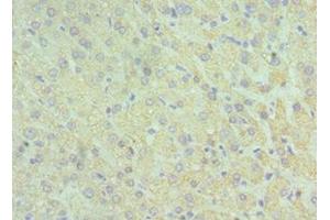 Immunohistochemistry of paraffin-embedded human liver tissue using ABIN7153959 at dilution of 1:100 (GLUD2 anticorps  (AA 319-558))