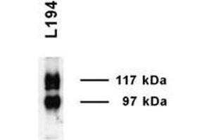 UT A1 Immunoblot (Rat inner medulla).