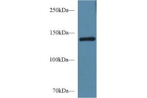 Western Blot; Sample: Mouse Serum; Primary Ab: 1µg/ml Rabbit Anti-Mouse SEMA4D Antibody Second Ab: 0. (SEMA4D/CD100 anticorps  (AA 502-636))