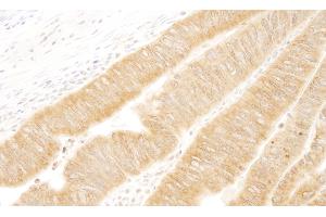 Immunohistochemistry (IHC) image for anti-UV Radiation Resistance Associated Gene (UVRAG) (AA 649-699) antibody (ABIN7448857)