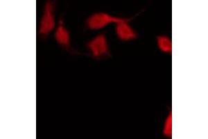 ABIN6267590 staining HeLa by IF/ICC.