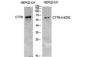 Western Blot (WB) analysis of HepG2-UV cells using Acetyl-Cortactin (K235) Polyclonal Antibody. (Cortactin anticorps  (acLys235))