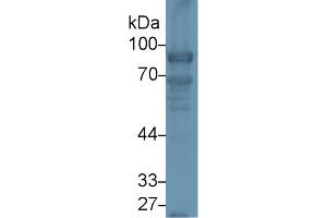 Detection of NEXN in Rat Lung lysate using Polyclonal Antibody to Nexilin (NEXN)