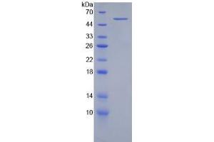 SDS-PAGE of Protein Standard from the Kit (Highly purified E. (Integrin beta 2 Kit ELISA)