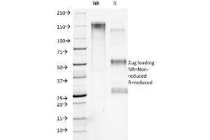 SDS-PAGE Analysis Purified Collagen VII Mouse Monoclonal Antibody (LH7. (COL7A1 anticorps)