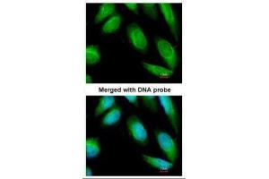 ICC/IF Image Immunofluorescence analysis of paraformaldehyde-fixed HeLa, using Creatine Kinase BB, antibody at 1:100 dilution.
