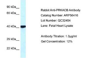 WB Suggested Anti-PRKACB Antibody Titration: 0.