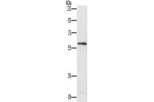 Gel: 8 % SDS-PAGE, Lysate: 40 μg, Lane: Mouse spleen tissue, Primary antibody: ABIN7131459(TRAFD1 Antibody) at dilution 1/400, Secondary antibody: Goat anti rabbit IgG at 1/8000 dilution, Exposure time: 4 minutes (TRAFD1 anticorps)