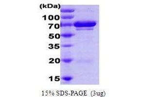 Figure annotation denotes ug of protein loaded and % gel used. (UBE2G1 Protéine)