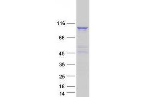 Validation with Western Blot