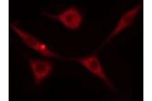 ABIN6274237 staining HeLa cells by IF/ICC. (GRK5 anticorps  (Internal Region))