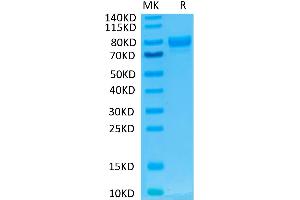 Human SIRP alpha V2/CD172a on Tris-Bis PAGE under reduced condition. (SIRP AlphaV2 (AA 31-369) protein (Fc Tag))