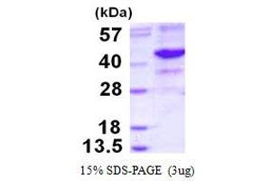 Image no. 1 for Endonuclease 8-like 2 (NEIL2) (AA 1-332) protein (His tag) (ABIN1098272)