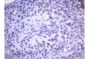 Image no. 1 for anti-Mdm2, p53 E3 Ubiquitin Protein Ligase Homolog (Mouse) (MDM2) (AA 119-438) antibody (ABIN1490872)