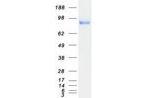 Validation with Western Blot