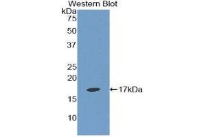 Western Blotting (WB) image for anti-Epsin 1 (EPN1) (AA 279-437) antibody (ABIN1858728) (Epsin 1 anticorps  (AA 279-437))