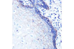 Immunohistochemistry of paraffin-embedded human esophageal using Na+/K+-ATPase Rabbit mAb (ABIN7270390) at dilution of 1:100 (40x lens).