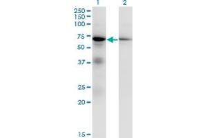 Western Blot analysis of EIF2AK2 expression in transfected 293T cell line by EIF2AK2 monoclonal antibody (M01), clone 1B9.