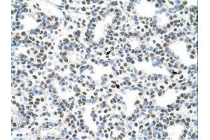 anti-A Kinase (PRKA) Anchor Protein 8-Like (AKAP8L) (C-Term) antibody