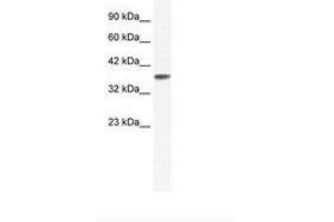 Image no. 1 for anti-Potassium Channel, Subfamily K, Member 3 (KCNK3) (C-Term) antibody (ABIN202419) (KCNK3 anticorps  (C-Term))