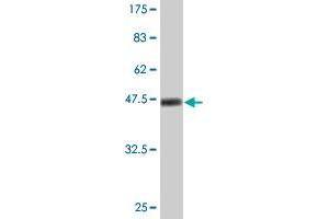 Western Blot detection against Immunogen (47. (Ube2t anticorps  (AA 1-197))