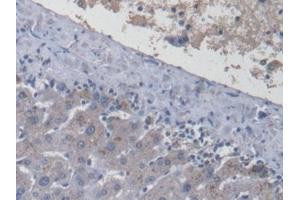 Detection of LRG1 in Human Liver Tissue using Monoclonal Antibody to Leucine Rich Alpha-2-Glycoprotein 1 (LRG1) (LRG1 anticorps  (AA 37-340))
