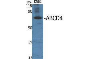 Western Blot (WB) analysis of specific cells using ABCD4 Polyclonal Antibody. (ABCD4 anticorps  (Internal Region))