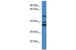 Western Blot showing RTN4IP1 antibody used at a concentration of 1 ug/ml against Fetal Kidney Lysate (RTN4IP1 anticorps  (Middle Region))