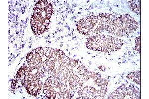 Immunohistochemistry (IHC) image for anti-Keratin 5 (KRT5) (AA 316-590) antibody (ABIN1845567) (Cytokeratin 5 anticorps  (AA 316-590))