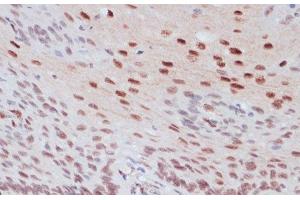 Immunohistochemistry of paraffin-embedded Human esophageal using Phospho-CREB1(S133) Polyclonal Antibody at dilution of 1:100 (40x lens). (CREB1 anticorps  (pSer133))