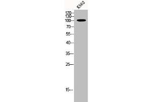 Western Blot analysis of K562 cells using p115 Polyclonal Antibody (USO1 anticorps  (C-Term))