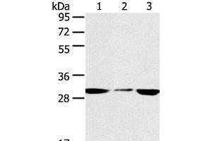 Western Blot analysis of PC3 and hepg2 cell, Human fetal liver tissue using SDHB Polyclonal Antibody at dilution of 1:400 (SDHB anticorps)