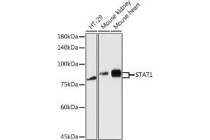 Western blot analysis of extracts of various cell lines, using ST antibody (ABIN3020614, ABIN3020615, ABIN3020616 and ABIN6213588) at 1:5000 dilution.